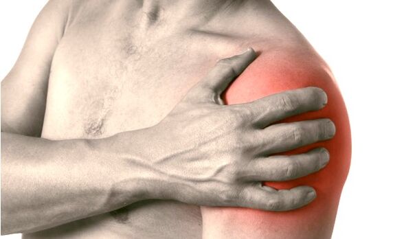 Oteklé, červené a zvětšené rameno - příznaky artrózy ramenního kloubu 2. -3