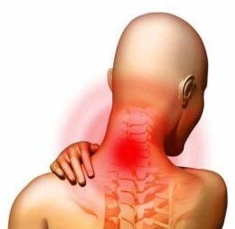 Osteochondróza krční páteře
