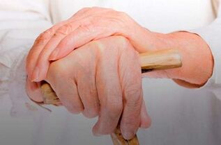 bolest kloubů prstů s revmatoidní artritidou