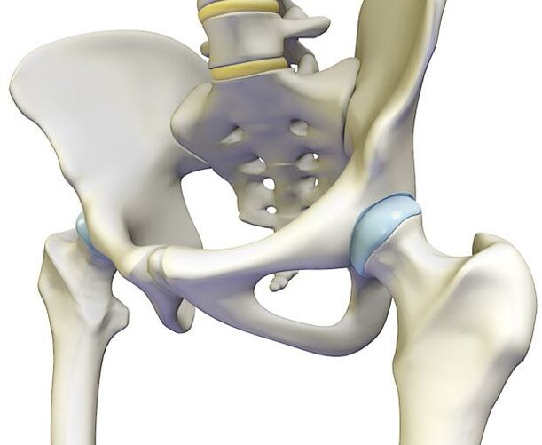 Osteochondróza vyvolává ostrou bolest v kyčelním kloubu